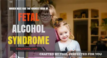 Risk Factors for Fetal Alcohol Syndrome: Race and Ethnicity