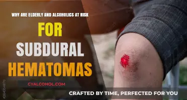Alcoholics and Elderly: Subdural Hematoma Risks