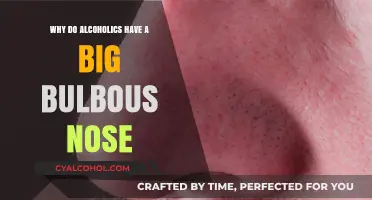 Alcoholic Nose: The Truth Behind Bulbous Rhinophyma Causes