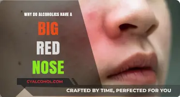 Alcoholic Nose: Understanding the Redness and Swelling in Drinkers