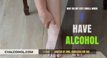Alcohol and Swollen Feet: What's the Link?