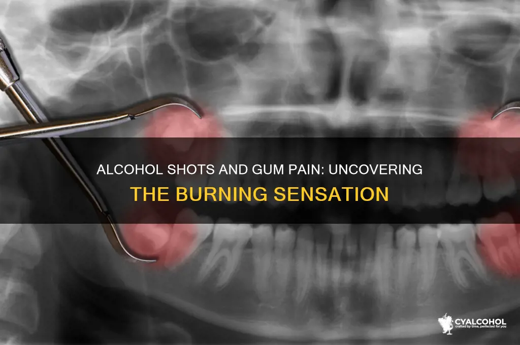 why do shots of alcohol hurt my gums