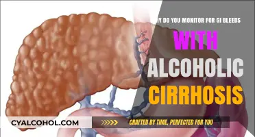 Monitoring GI Bleeds: Alcoholic Cirrhosis
