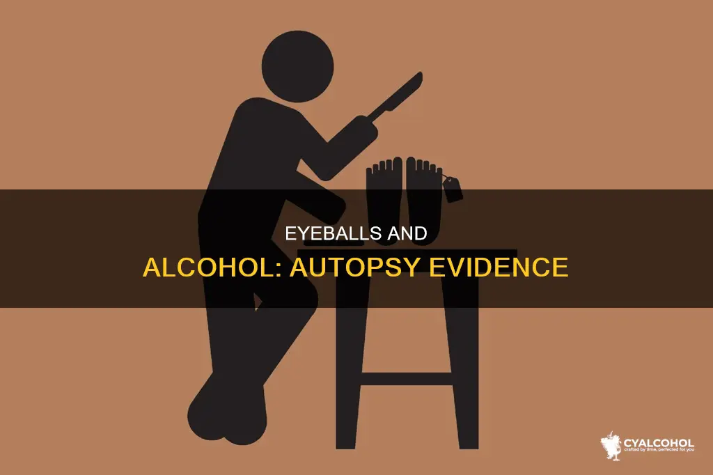 why does autopsy check the eyeballs for evidence of alcohol