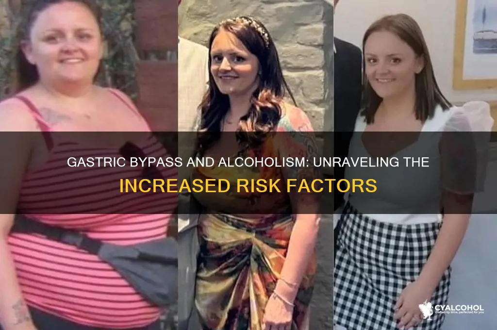 why does gastric bypass increase risk of alcoholism