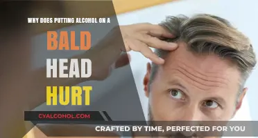 Bald Head, Alcohol Burns: Why the Pain?