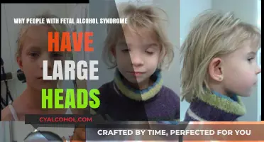 The Mystery of Large Heads in Fetal Alcohol Syndrome