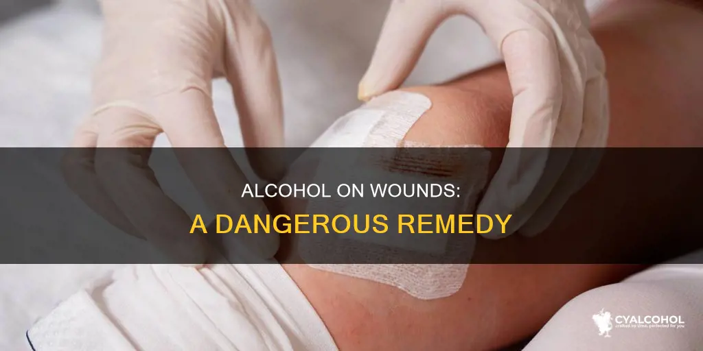 why should you not put alcohol on an open wound