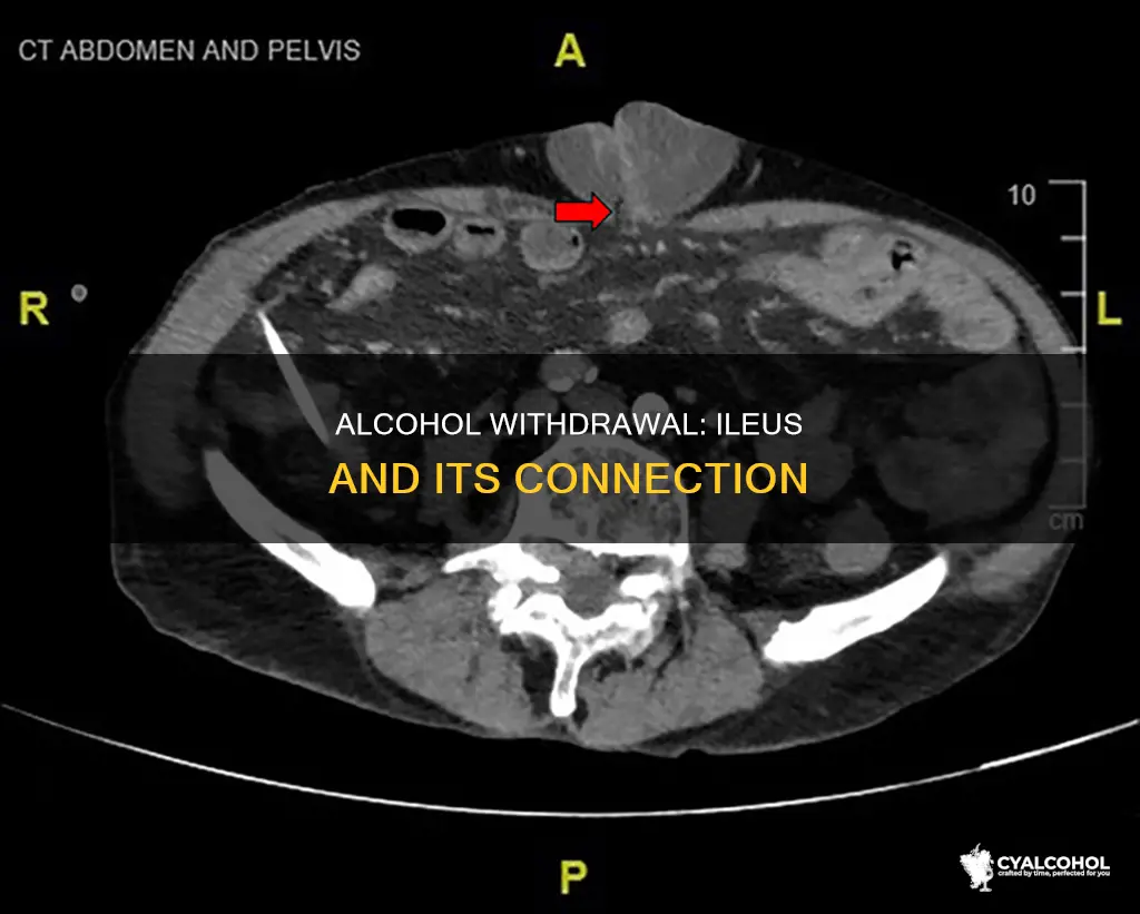 why would someone with alcohol withdrawal have an ileus