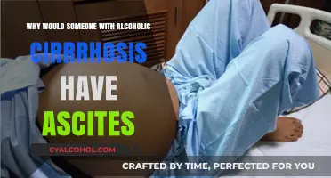 Alcoholic Cirrhosis and Ascites: Understanding the Fluid Buildup Connection